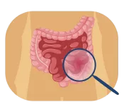 Understand the Root Cause of Your Disease